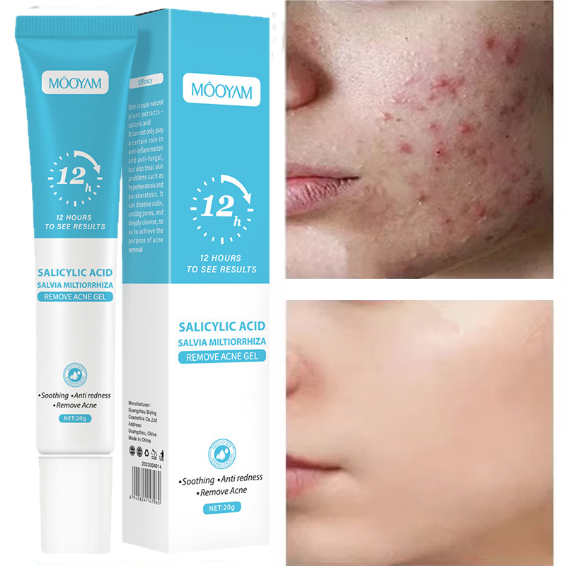 Crema para el acné para el ros - Korean Skincare Routine reseña y precio